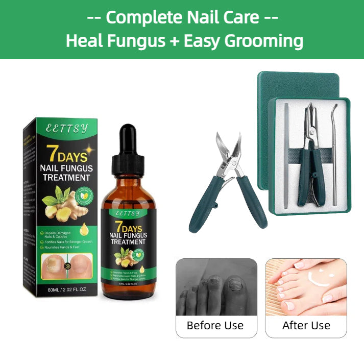 7 Day Nail Treatment Serum🍃Natural ingredients & Fast results