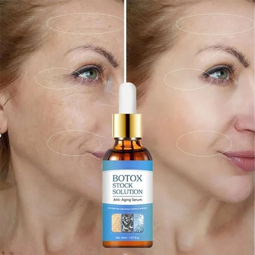 Last Day Promotion 49% OFF - 🔥Botox Face Serum