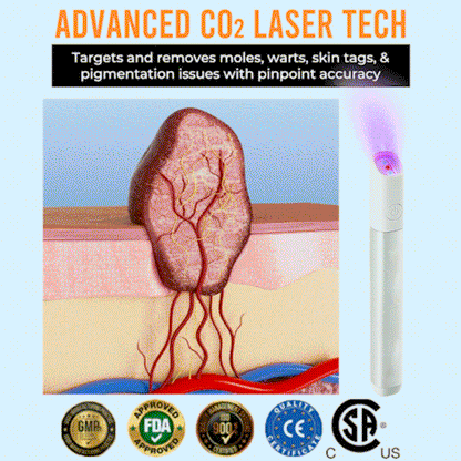 ✨All-in-One CO₂ Laser Eraser Pen | Removes Moles, Warts, Skin Flaws & Pigmentation