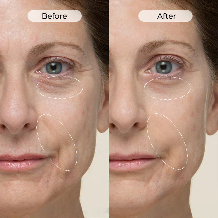 🌊[Official Store] 🌊3 hours: 80% off TightShift Precision Contour & Firming Serum