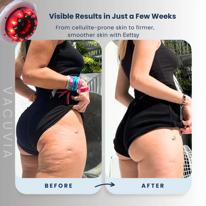 Eettsy®  – Firmer, More Toned Skin