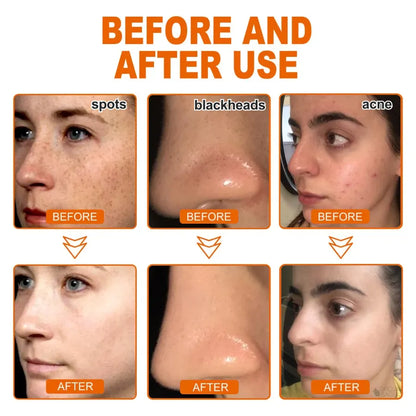 ✅Official Store | WHITEN AND LIGHTEN SPOTS MASK(Buy 1 Get 1 Free)