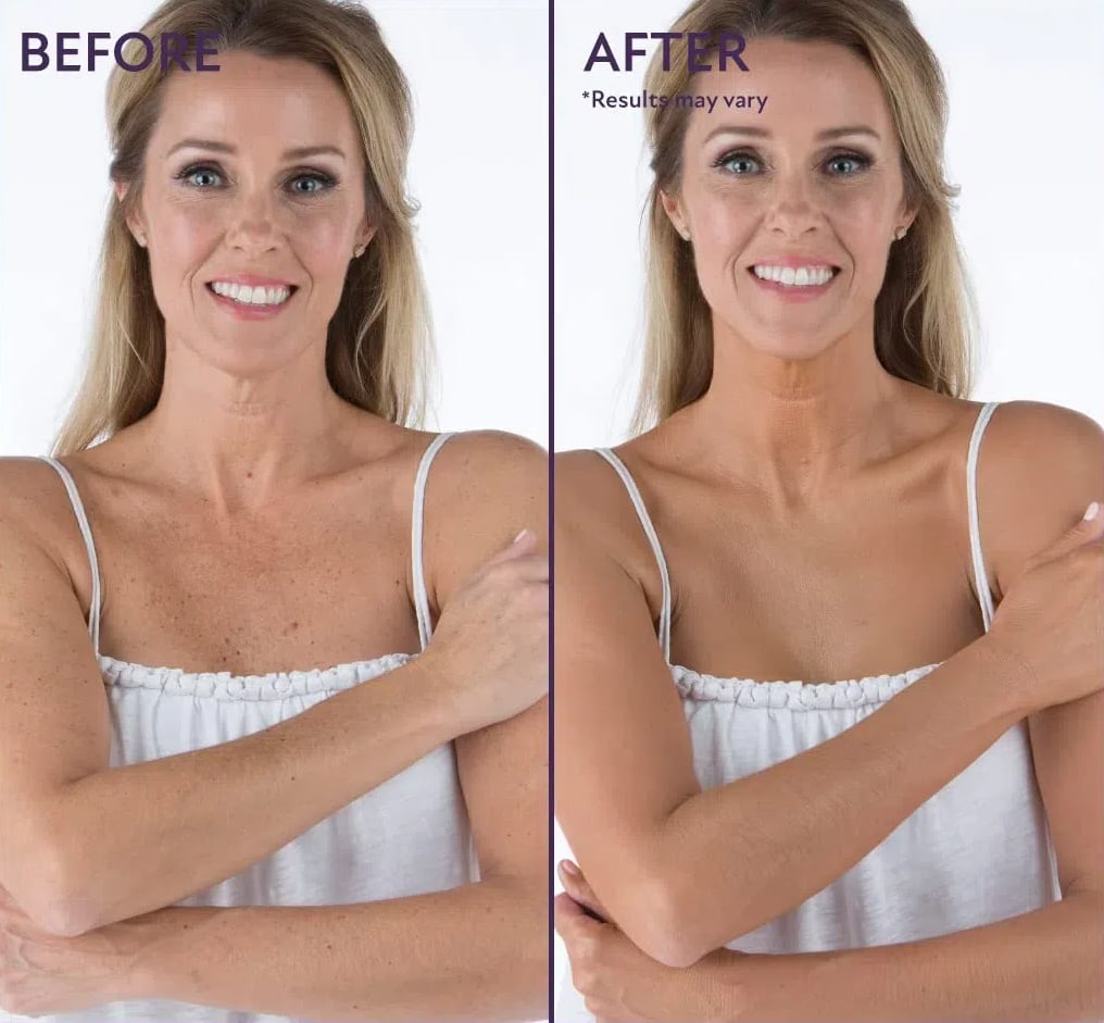 🏆Only $18.99🔥Last Day Promotion! - All Over Complexion Perfector