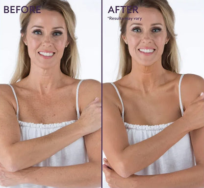 🏆Only $18.99🔥Last Day Promotion! - All Over Complexion Perfector