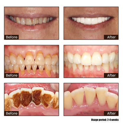 🦷 Niacinamide Whitening Toothpaste - For Healthier, Whiter Teeth!