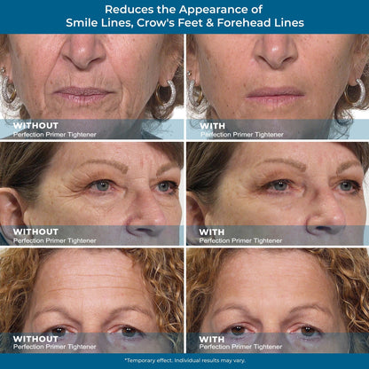 Instant Eye Firming Serum - Instantly Visibly Reduces Under-Eye Bags, Wrinkles, Dark Circles, Fine Lines, and Crow's Feet. Anti-Aging and Anti-Wrinkle Treatment for Full Face Size Tube.