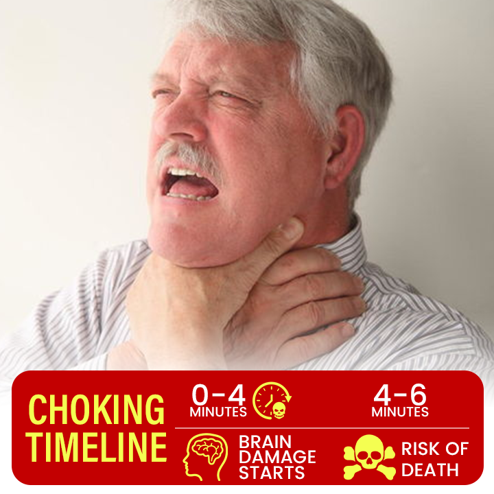 LifeAegis Anti-Choking Device