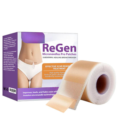 Official Store: ReGen Microneedles Pro Patches with Hyaluronic Acid Nano-Heal Treatment for new and old scars, reduction of surgical scars, stretch marks, keloids, acne, burns, warts, dermatomas, and varicose veins