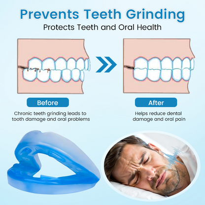 🌙 SILENT NIGHTS, STRONG TEETH! 🦷 Anti-Snoring Guard 🔵✨