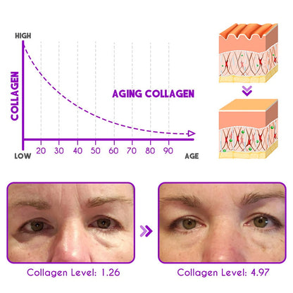 👀DEleventh Pro-Xylane Active Eye Cream🤩😍💃🏼