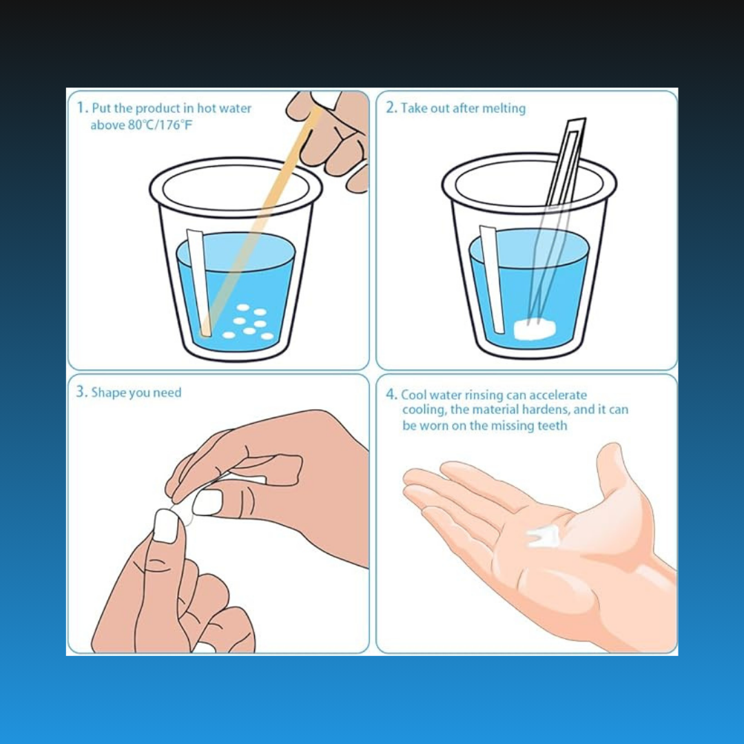 Dental Restoration Kit