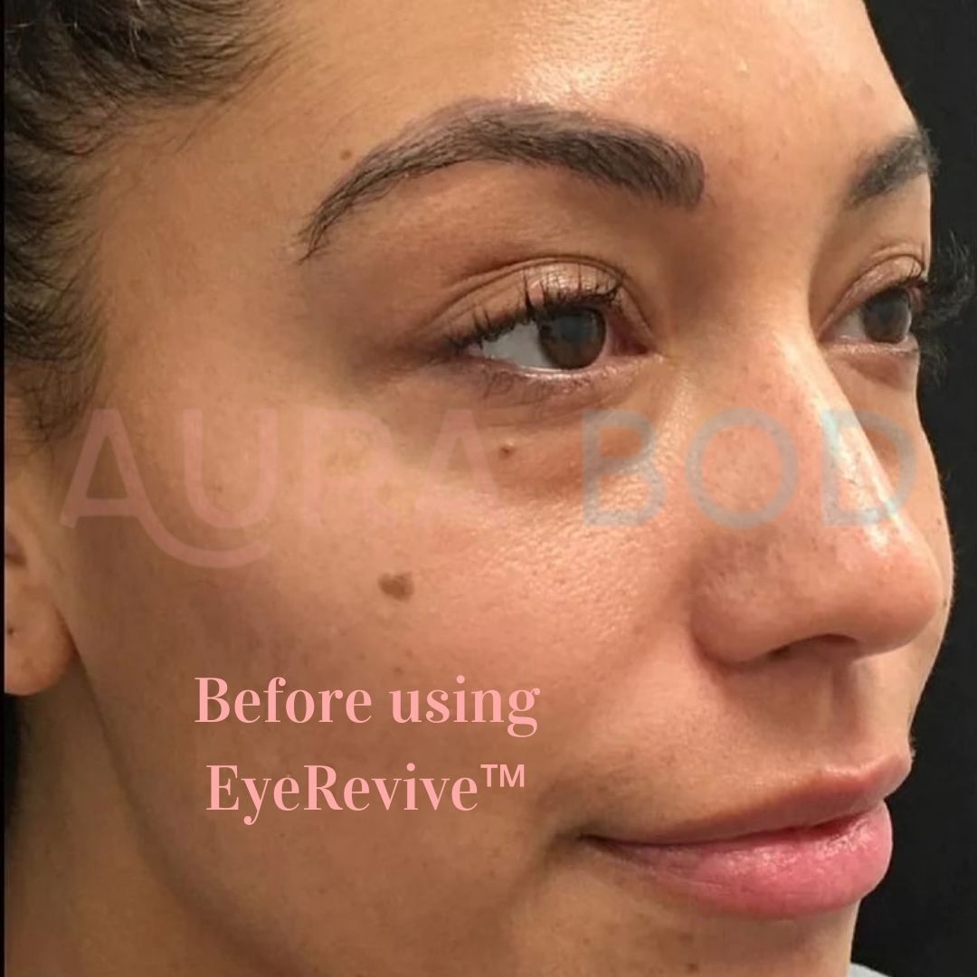 EETTSY™ Eye Massager