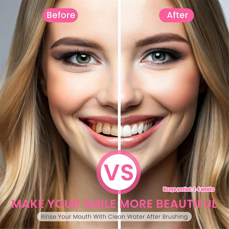 🦷 Niacinamide Whitening Toothpaste - For Healthier, Whiter Teeth!