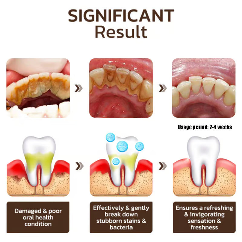 🦷 Niacinamide Whitening Toothpaste - For Healthier, Whiter Teeth!