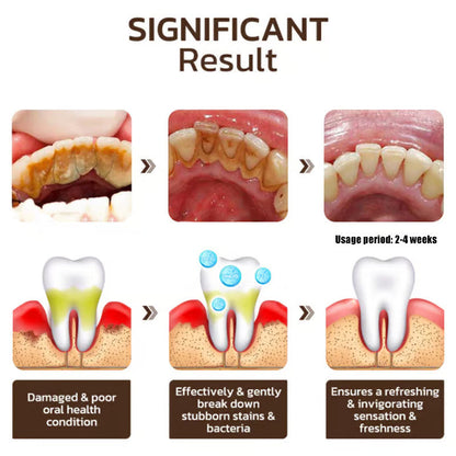 🦷 Niacinamide Whitening Toothpaste - For Healthier, Whiter Teeth!